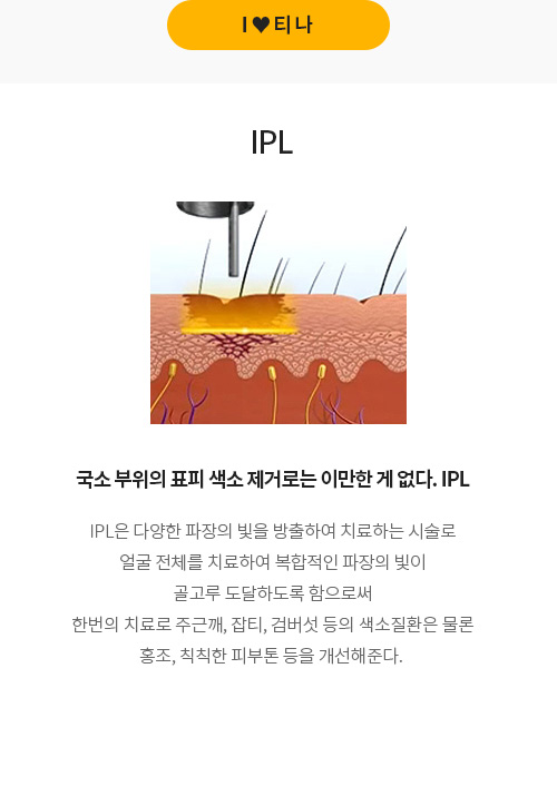 티나 잡티/미백 IPL