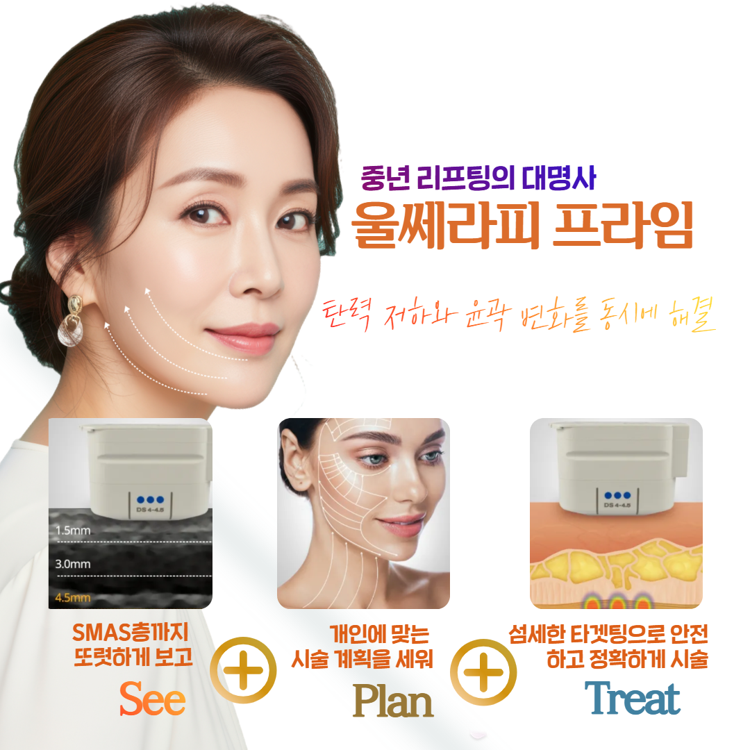 울쎄라피 프라임 특징