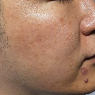 시술전  이미지 