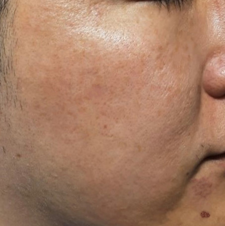 시술후   이미지