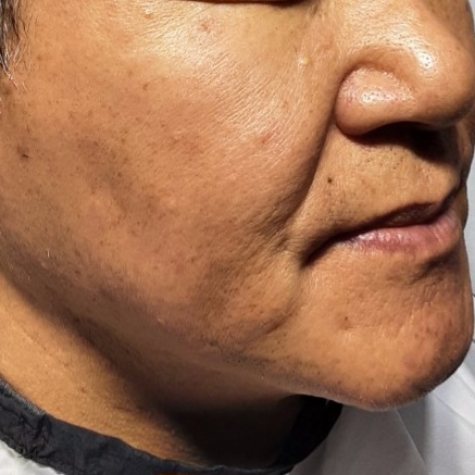 시술전  이미지 