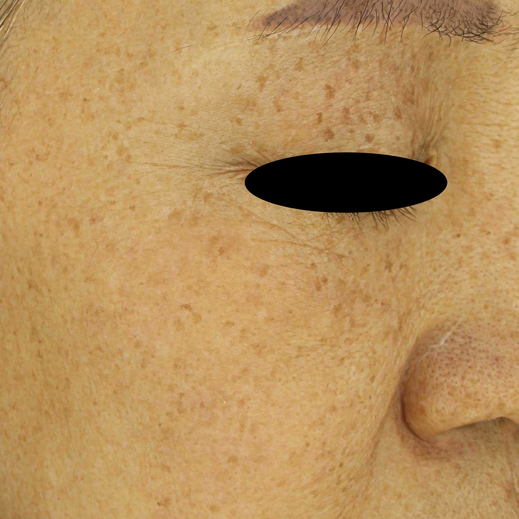 시술전  이미지 