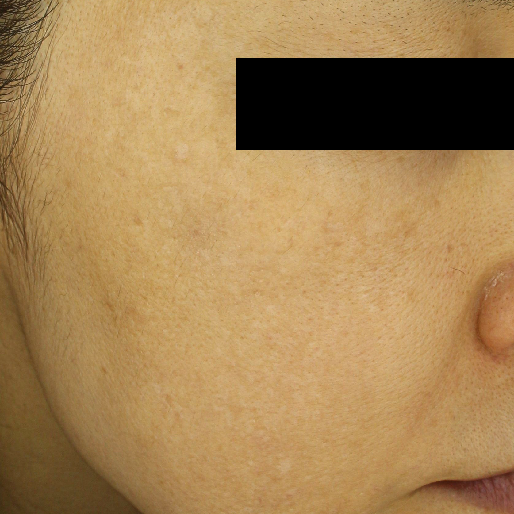 시술후   이미지