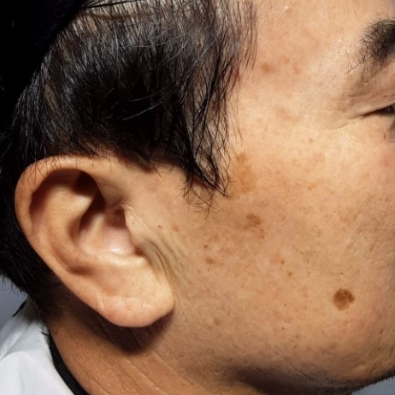 시술전  이미지 