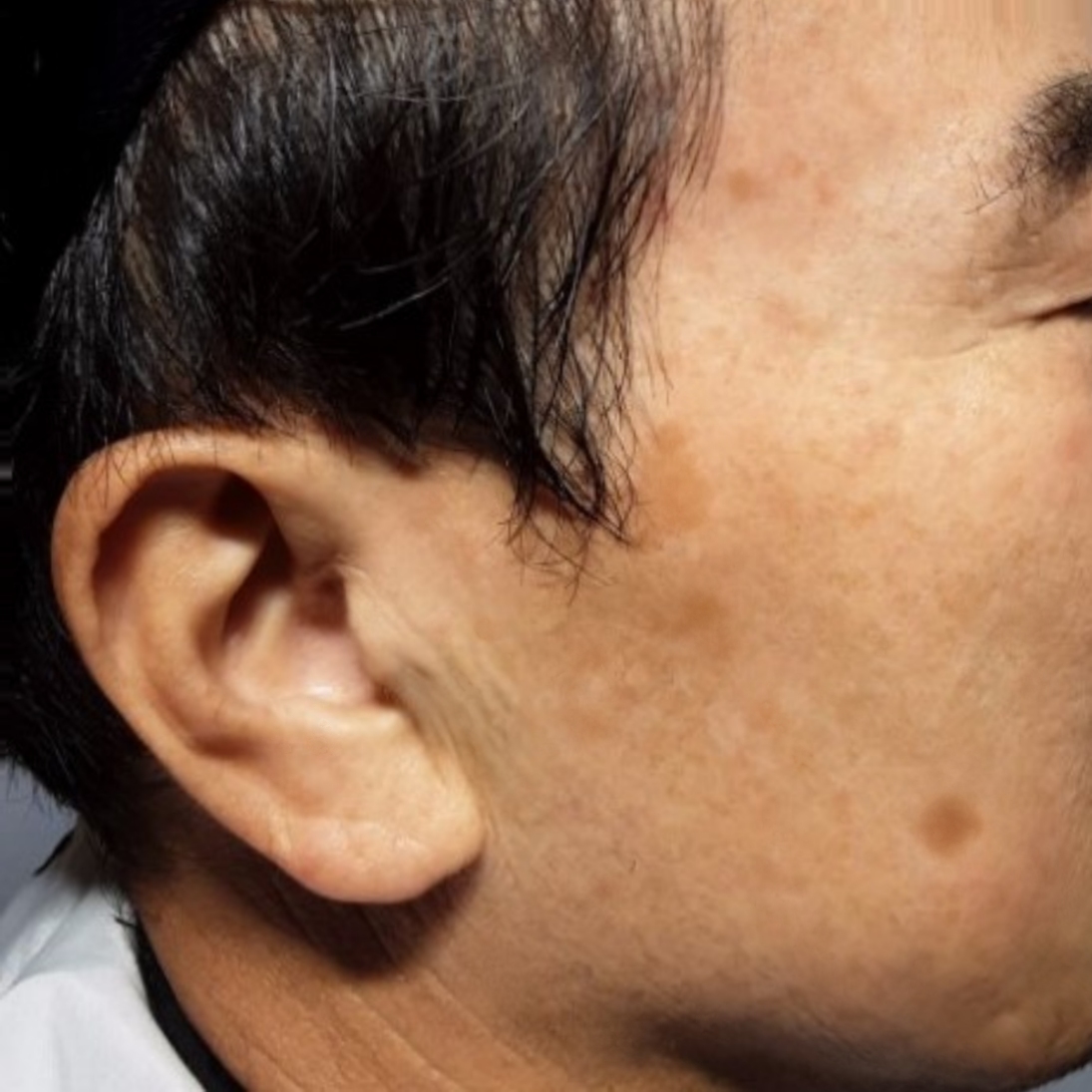 시술후   이미지