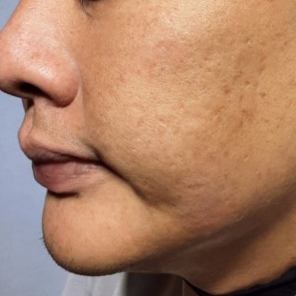 시술후   이미지